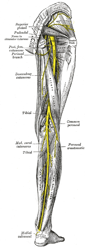 Figure 7.1a — Posterior view of right lower extremity nerves: sciatic dividing into common fibular (peroneal) and tibial; the FES electrode for foot drop sits over the common peroneal as it wraps the fibular head/neck