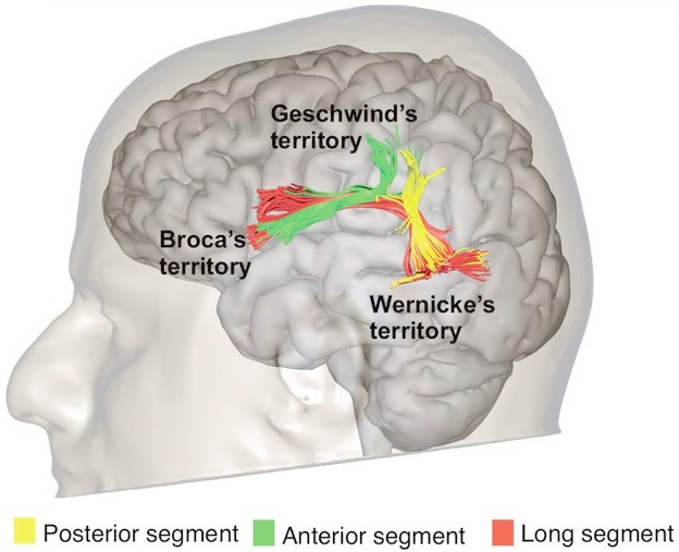 Figure 9.1a — Perisylvian language network (Broca + arcuate fasciculus + Wernicke)
