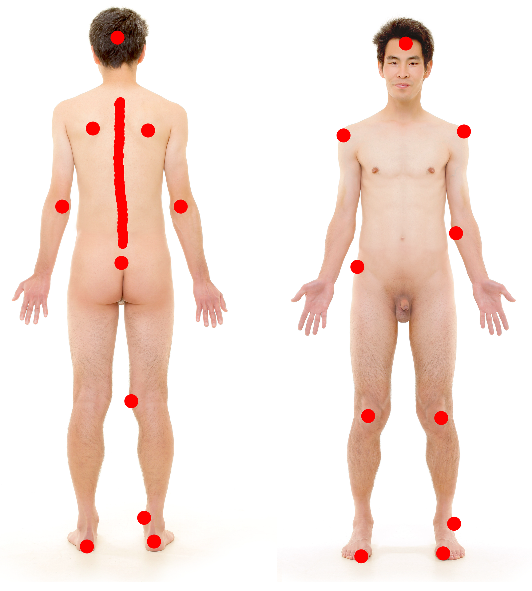 Figure 7.2 — Body diagram of pressure-vulnerable anatomical sites — bony prominences exposed by supine, lateral, and seated postures (sacrum, occiput, heels, scapulae, trochanter, malleolus, ischial tuberosities)